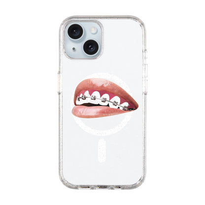 ORTHODONTIST-iPhone 15 Plus Shiny Kılıf MagSafe Özellikli
