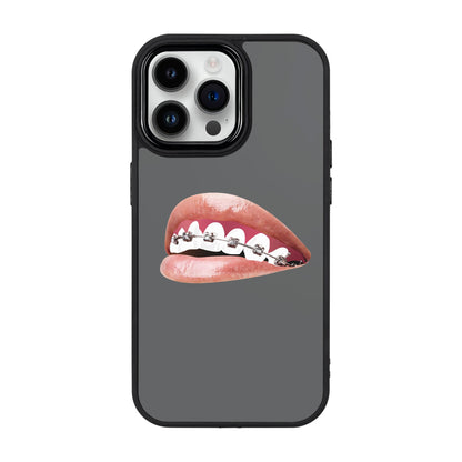 ORTHODONTIST-iPhone 14 Pro Max Proof Kılıf
