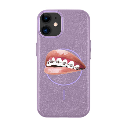 ORTHODONTIST-Radiant Kılıf MagSafe Özellikli - iPhone 11