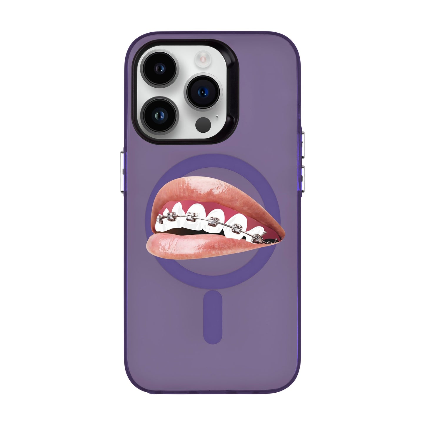 ORTHODONTIST-iPhone 14 Pro Hold Kılıf MagSafe Özellikli