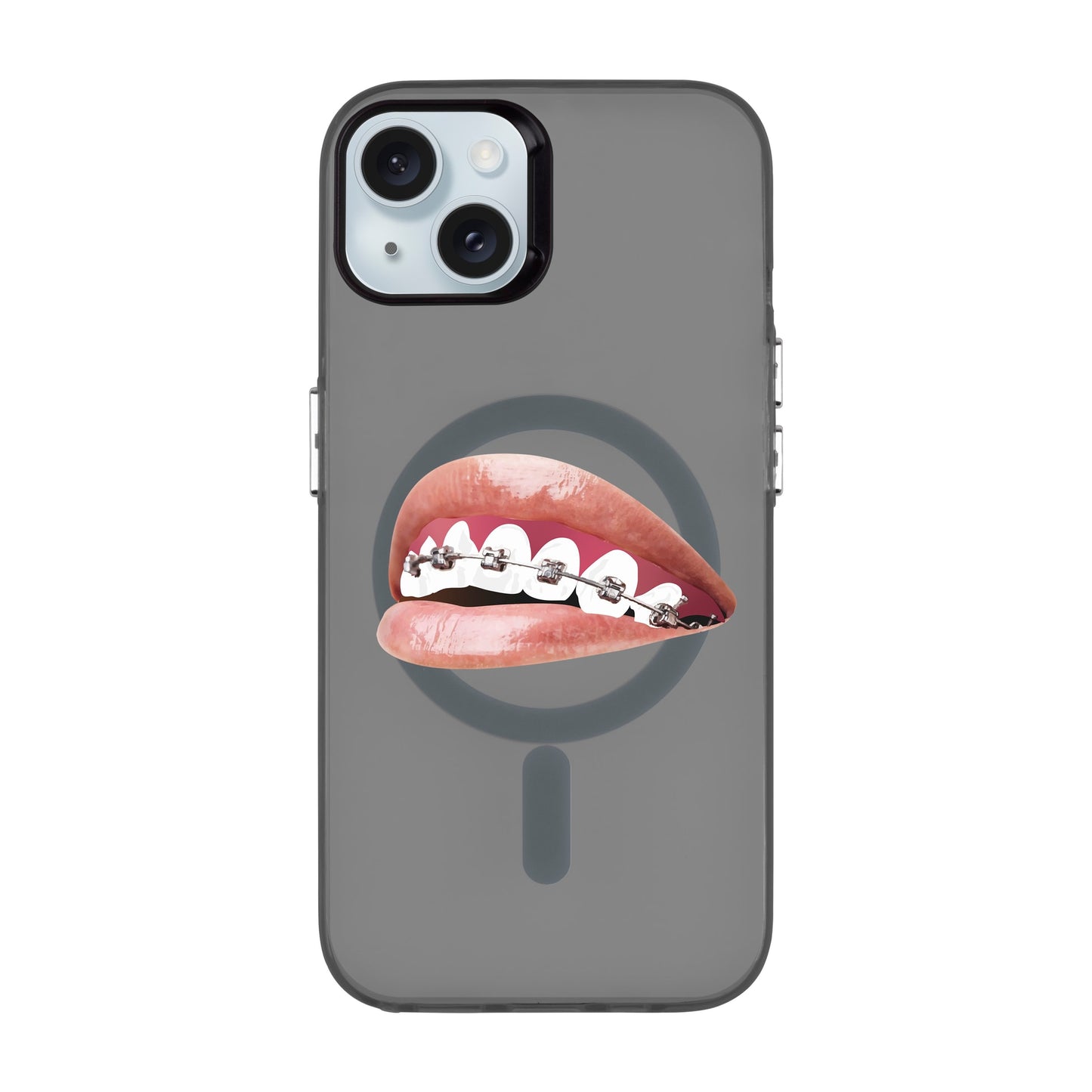 ORTHODONTIST-iPhone 15 Plus Hold Kılıf MagSafe Özellikli