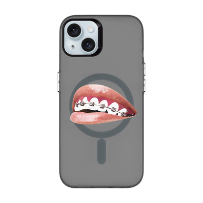 ORTHODONTIST-iPhone 15 Plus Hold Kılıf MagSafe Özellikli