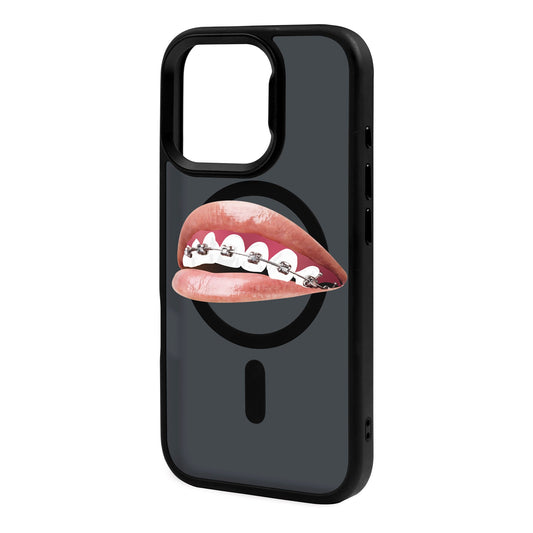 ORTHODONTIST-iPhone 16 Pro Max Rise Kılıf MagSafe Özellikli