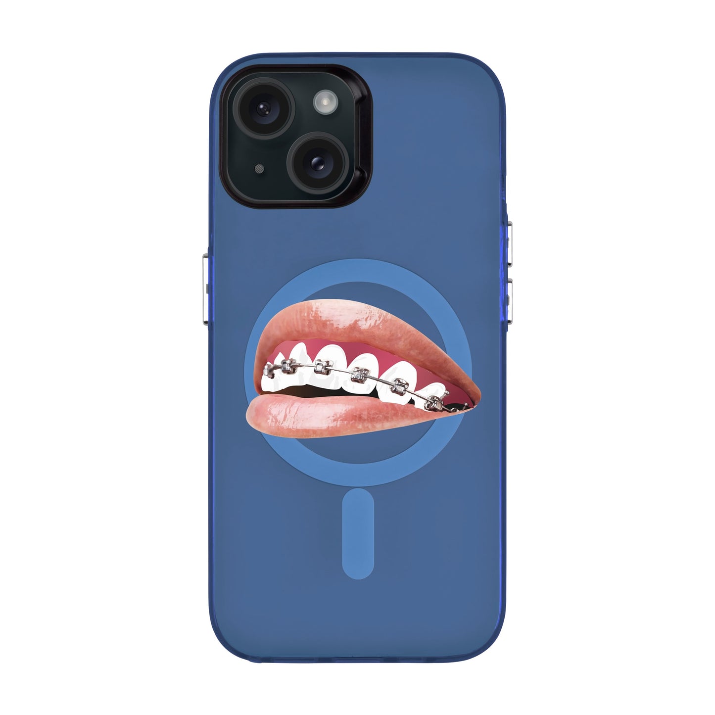 ORTHODONTIST-iPhone 15 Hold Kılıf MagSafe Özellikli