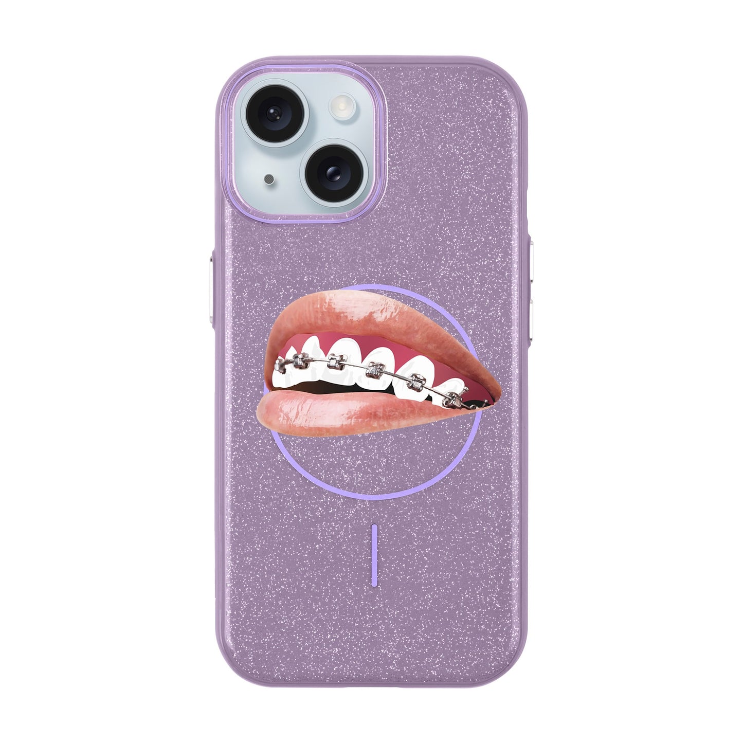 ORTHODONTIST-Radiant Kılıf MagSafe Özellikli - iPhone 15