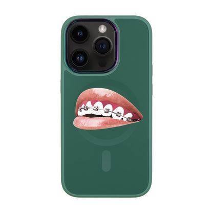 ORTHODONTİST-Vigor Kılıf MagSafe Özellikli - iPhone 14 Pro