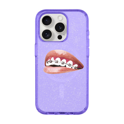 ORTHODONTIST-iPhone 15 Pro Shiny Kılıf MagSafe Özellikli