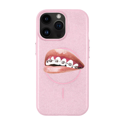 ORTHODONTIST-iPhone 14 Pro Max Radiant Kılıf MagSafe Özellikli