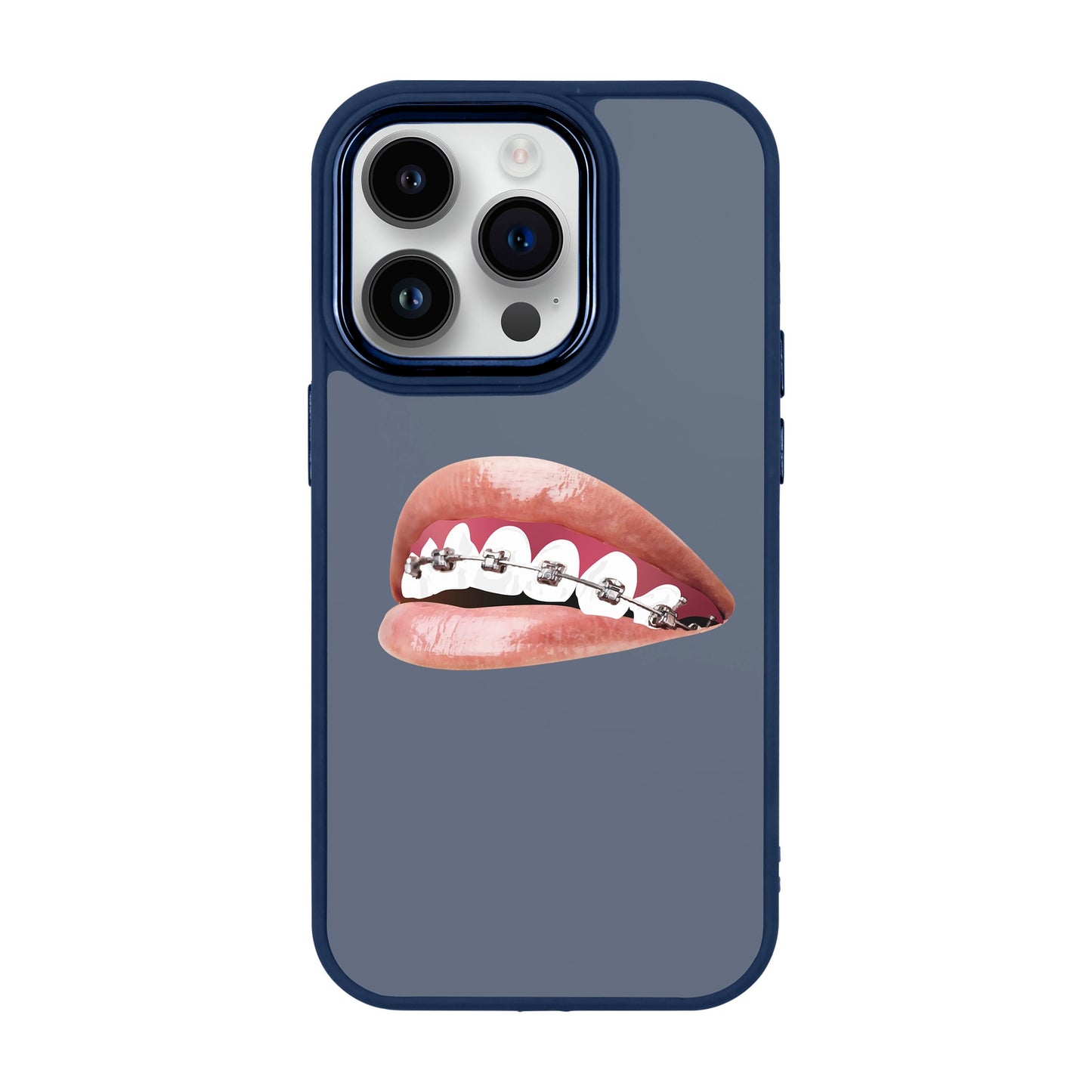 ORTHODONTIST-Proof Kılıf - iPhone 13 Pro