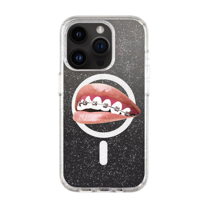 ORTHODONTIST-iPhone 14 Pro Shiny Kılıf MagSafe Özellikli