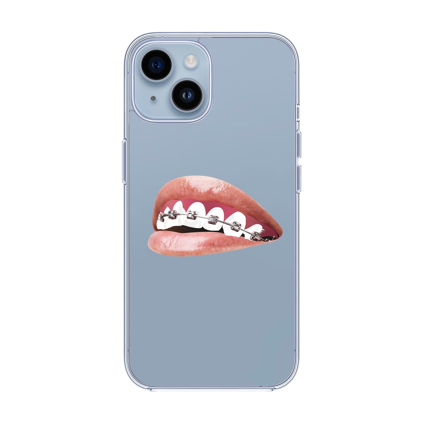 ORTHODONTIST-iPhone 14 Solid Kılıf