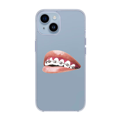ORTHODONTIST-iPhone 14 Solid Kılıf