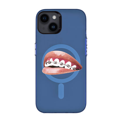 ORTHODONTIST-iPhone 14 Plus Hold Kılıf MagSafe Özellikli