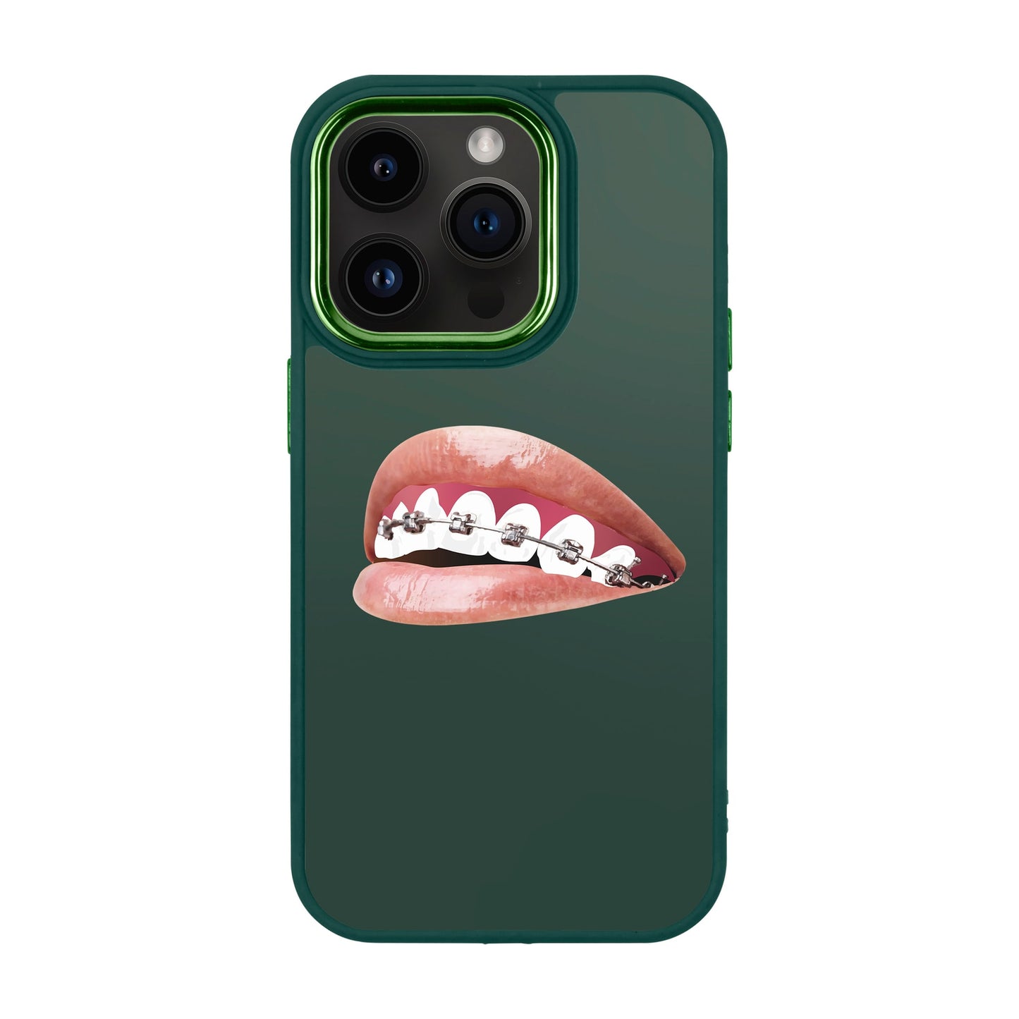 ORTHODONTIST-iPhone 14 Pro Proof Kılıf