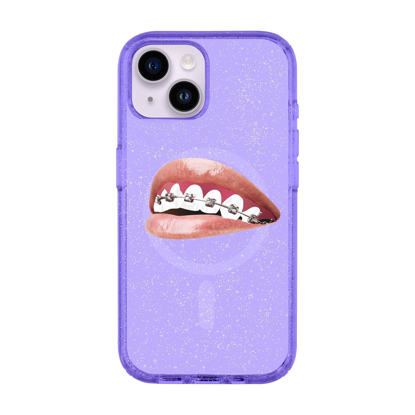 ORTHODONTIST-Shiny Kılıf MagSafe Özellikli - iPhone 13