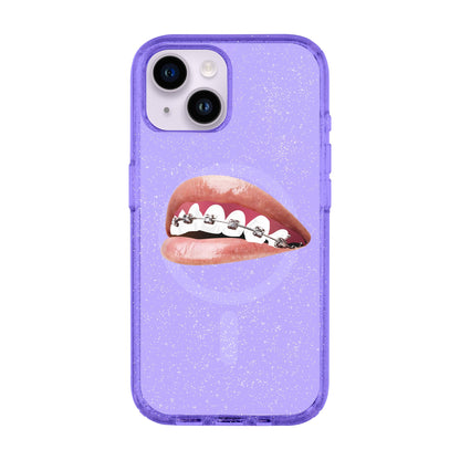 ORTHODONTIST-Shiny Kılıf MagSafe Özellikli - iPhone 13