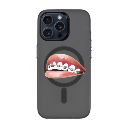 ORTHODONTIST-iPhone 15 Pro Max Hold Kılıf MagSafe Özellikli