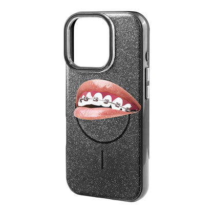 ORTHODONTIST-iPhone 16 Pro Max Radiant Kılıf MagSafe Özellikli