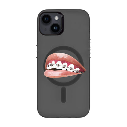 ORTHODONTIST-iPhone 14 Plus Hold Kılıf MagSafe Özellikli