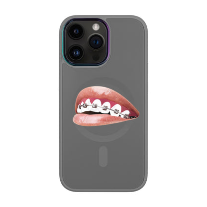 ORTHODONTİST-iPhone 14 Pro Max Vigor Kılıf MagSafe Özellikli