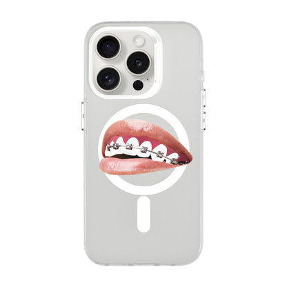 ORTHODONTIST-iPhone 15 Pro Hold Kılıf MagSafe Özellikli