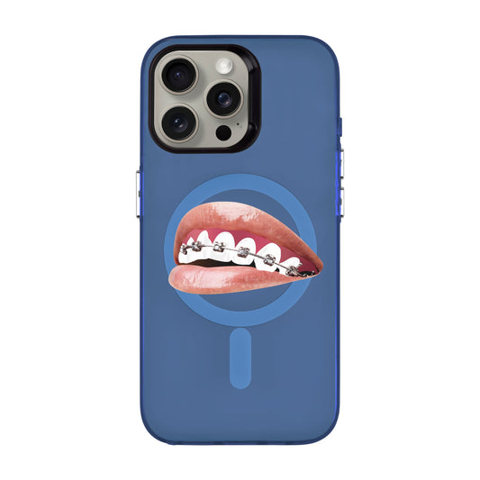 ORTHODONTIST-iPhone 15 Pro Max Hold Kılıf MagSafe Özellikli