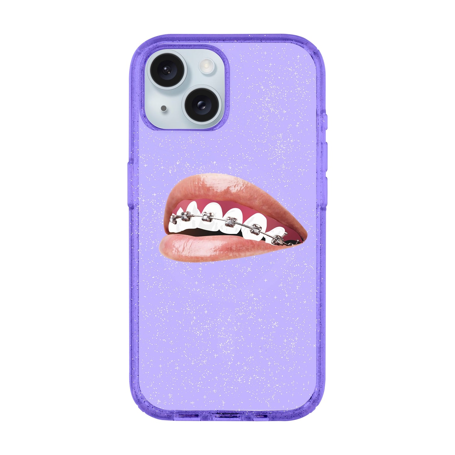 ORTHODONTIST-iPhone 15 Plus Shiny Kılıf MagSafe Özellikli