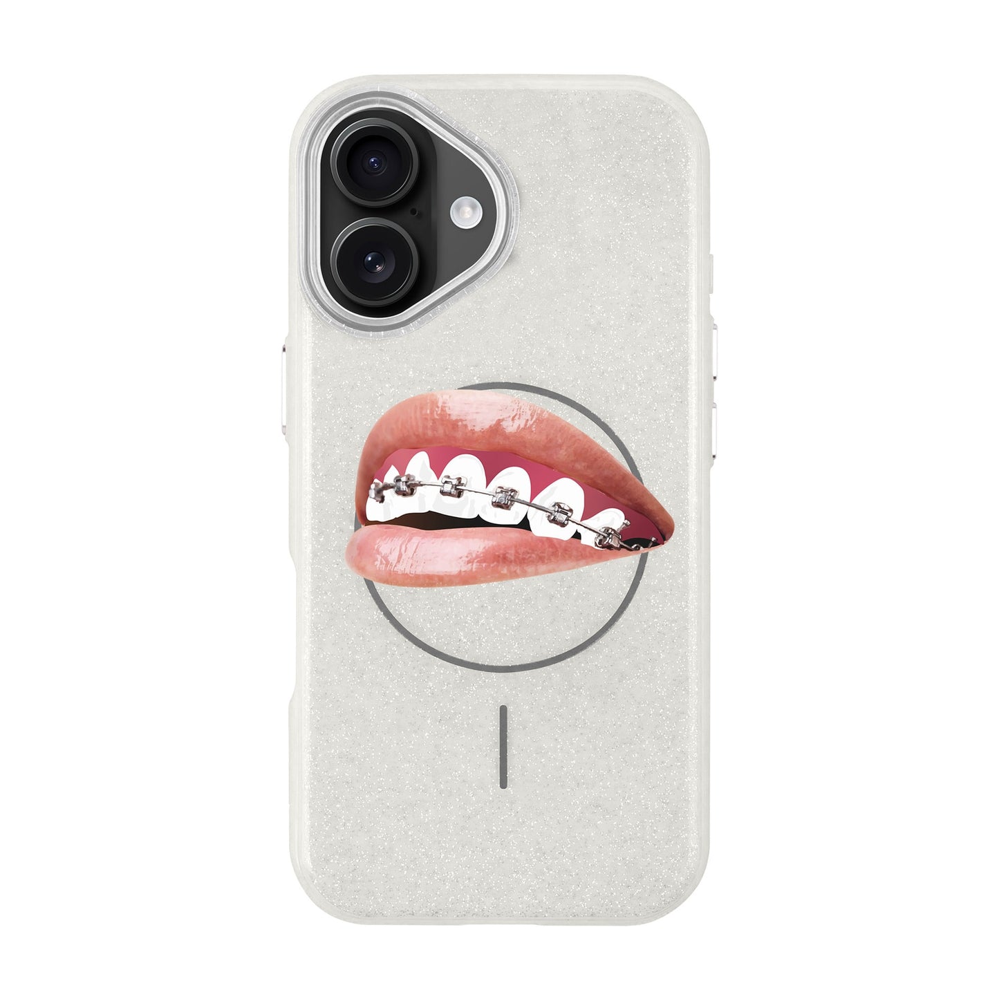 ORTHODONTIST-iPhone 16 Plus Radiant Kılıf MagSafe Özellikli