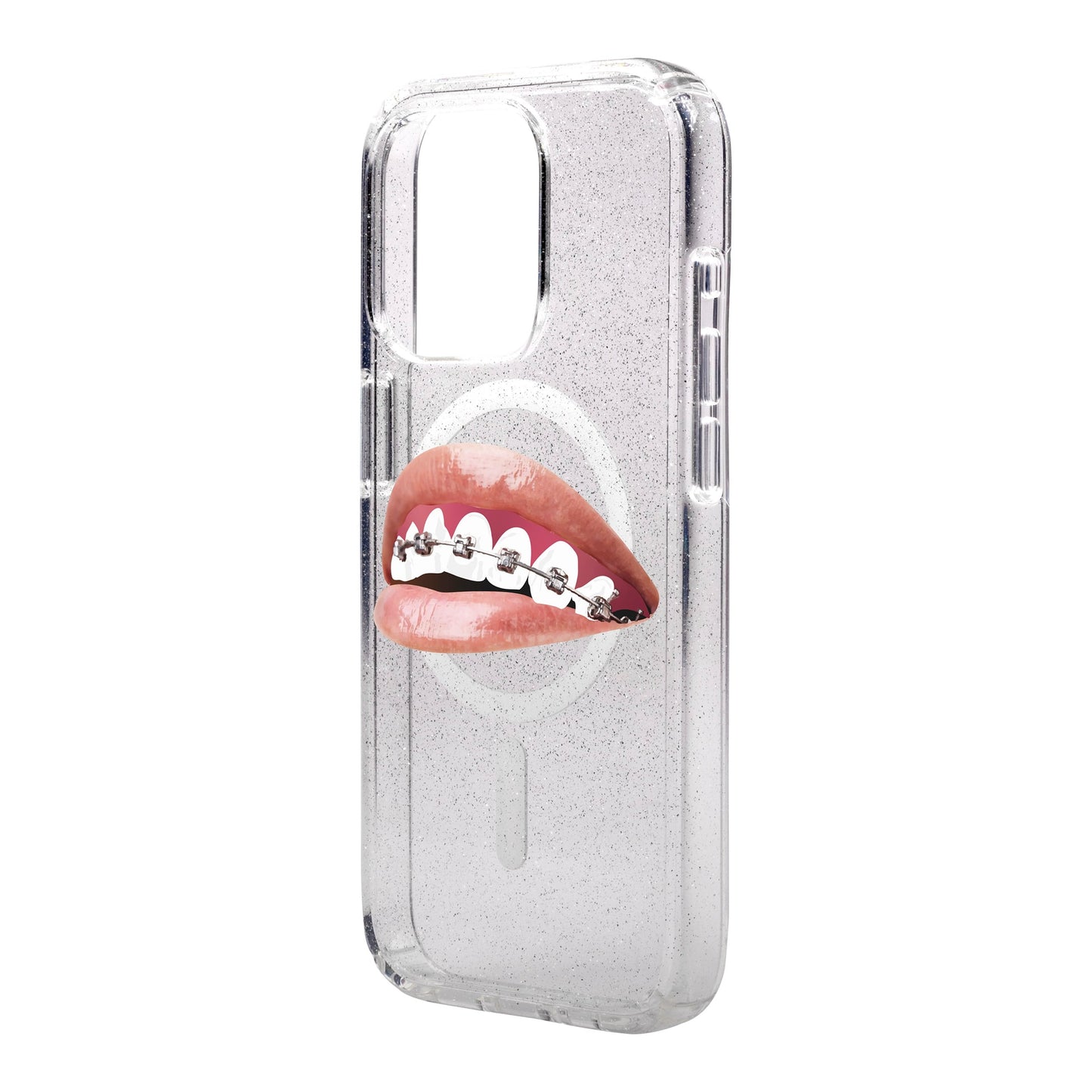 ORTHODONTIST-Shiny Kılıf MagSafe Özellikli - iPhone 13