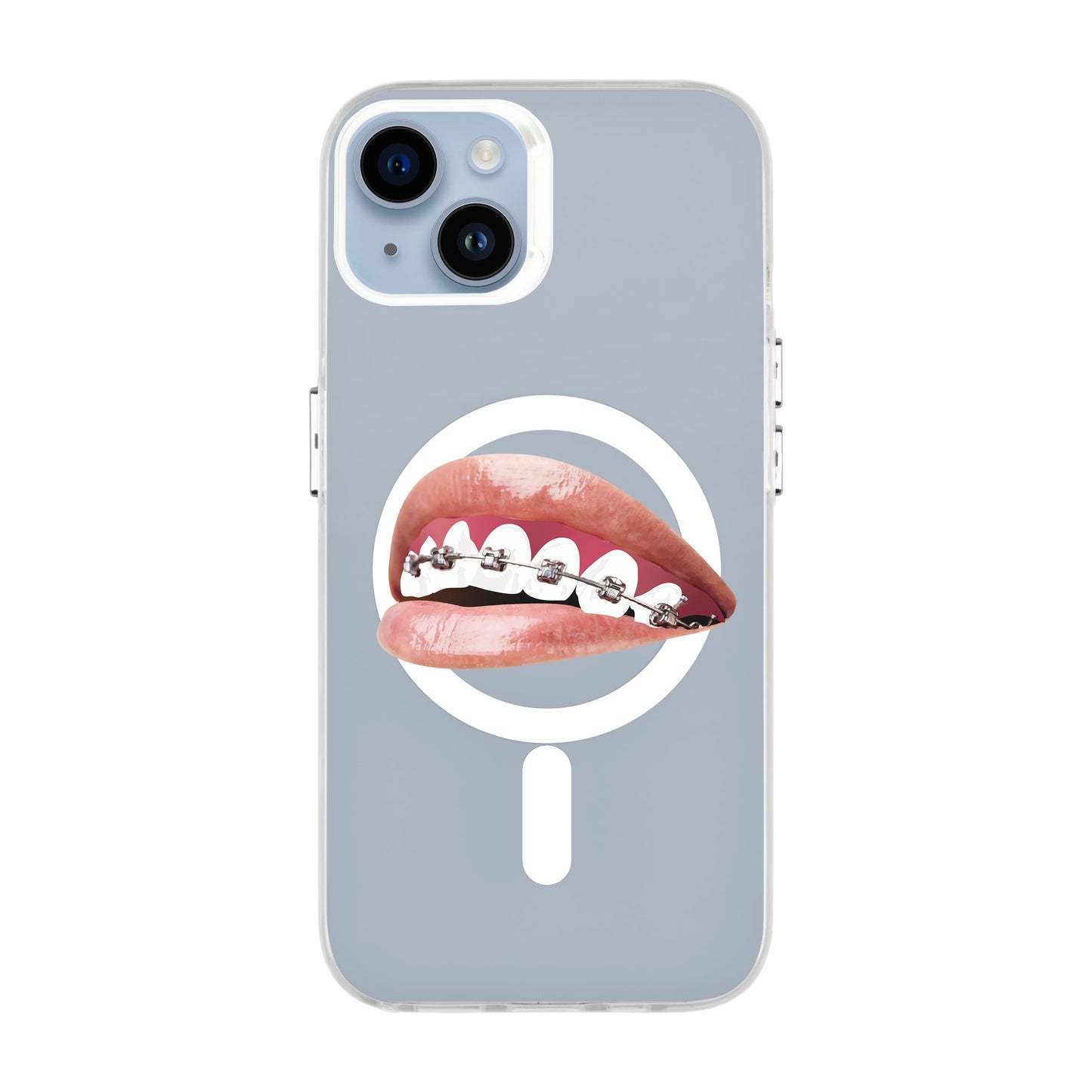 ORTHODONTIST-iPhone 14 Plus Hold Kılıf MagSafe Özellikli