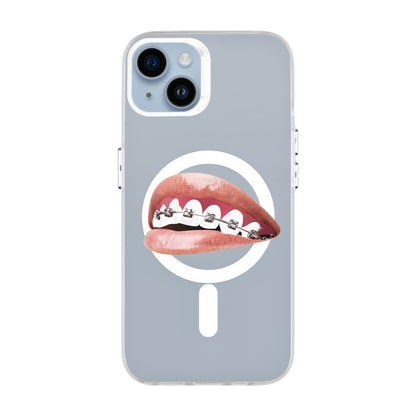 ORTHODONTIST-iPhone 14 Plus Hold Kılıf MagSafe Özellikli