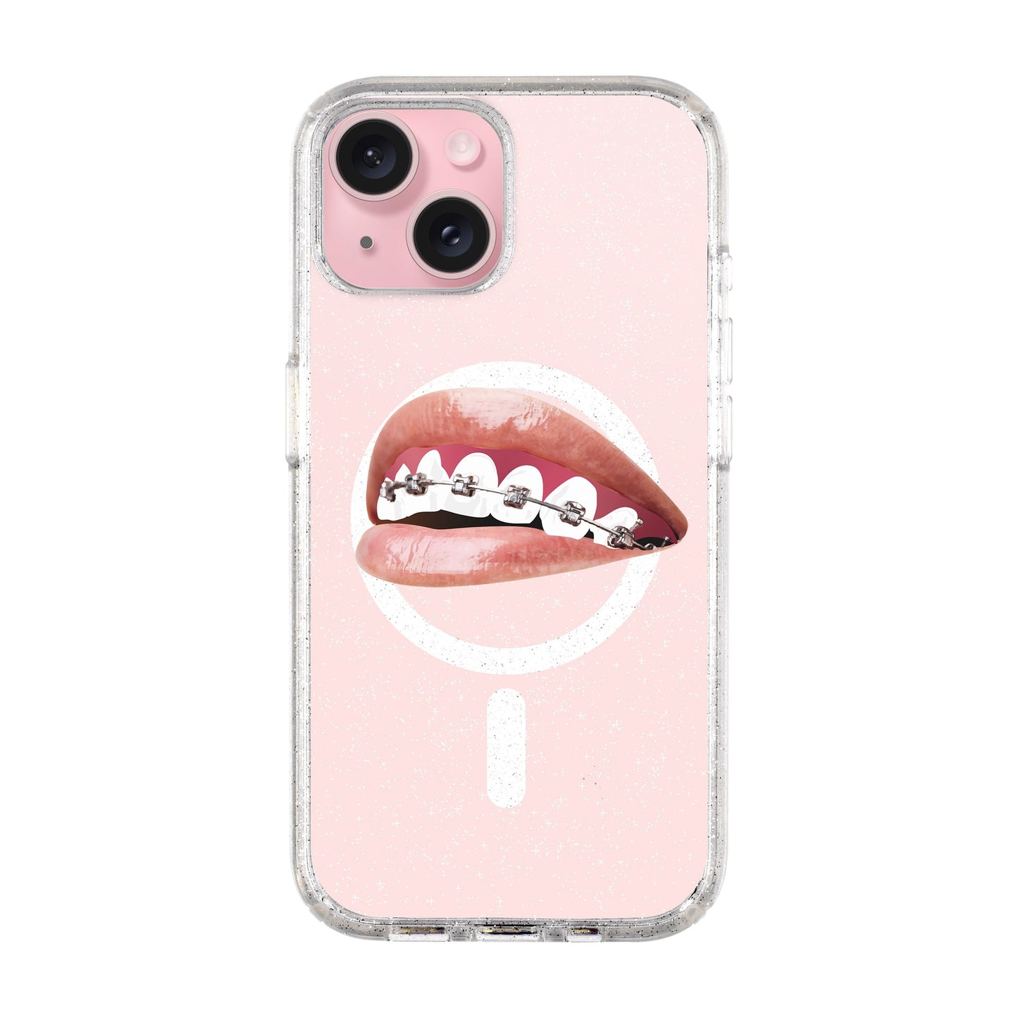 ORTHODONTIST-iPhone 15 Plus Shiny Kılıf MagSafe Özellikli