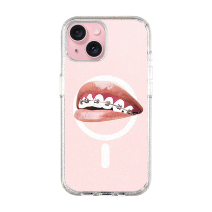 ORTHODONTIST-iPhone 15 Plus Shiny Kılıf MagSafe Özellikli