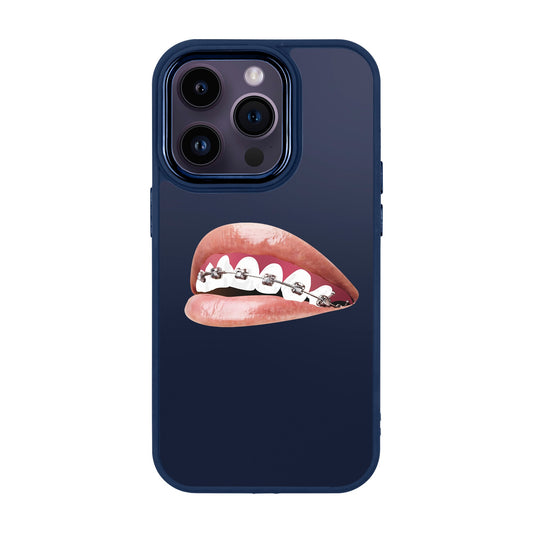 ORTHODONTIST-iPhone 14 Pro Proof Kılıf
