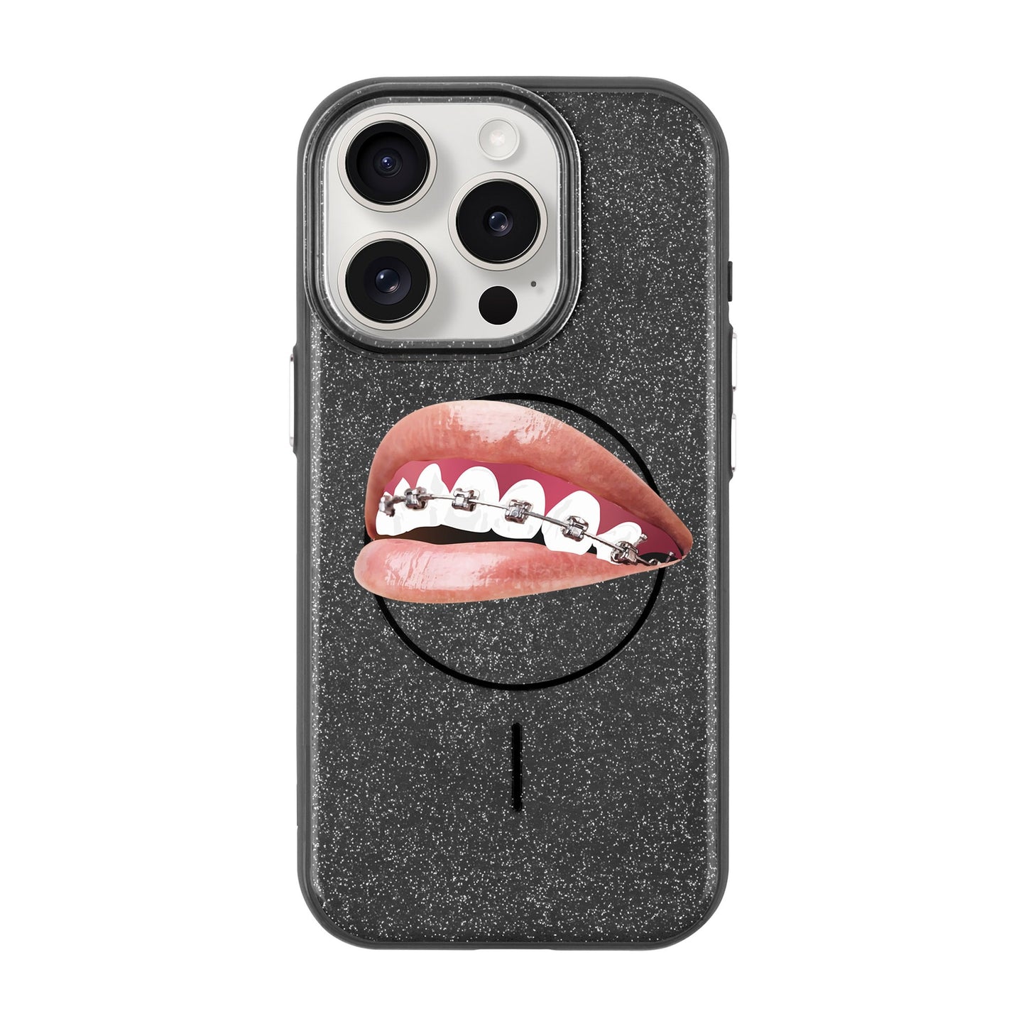 ORTHODONTIST-Radiant Kılıf MagSafe Özellikli - iPhone 15 Pro