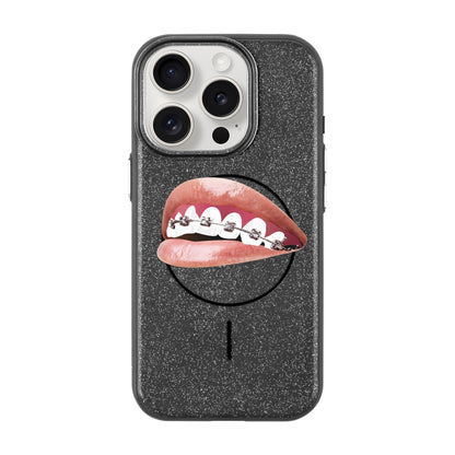 ORTHODONTIST-Radiant Kılıf MagSafe Özellikli - iPhone 15 Pro