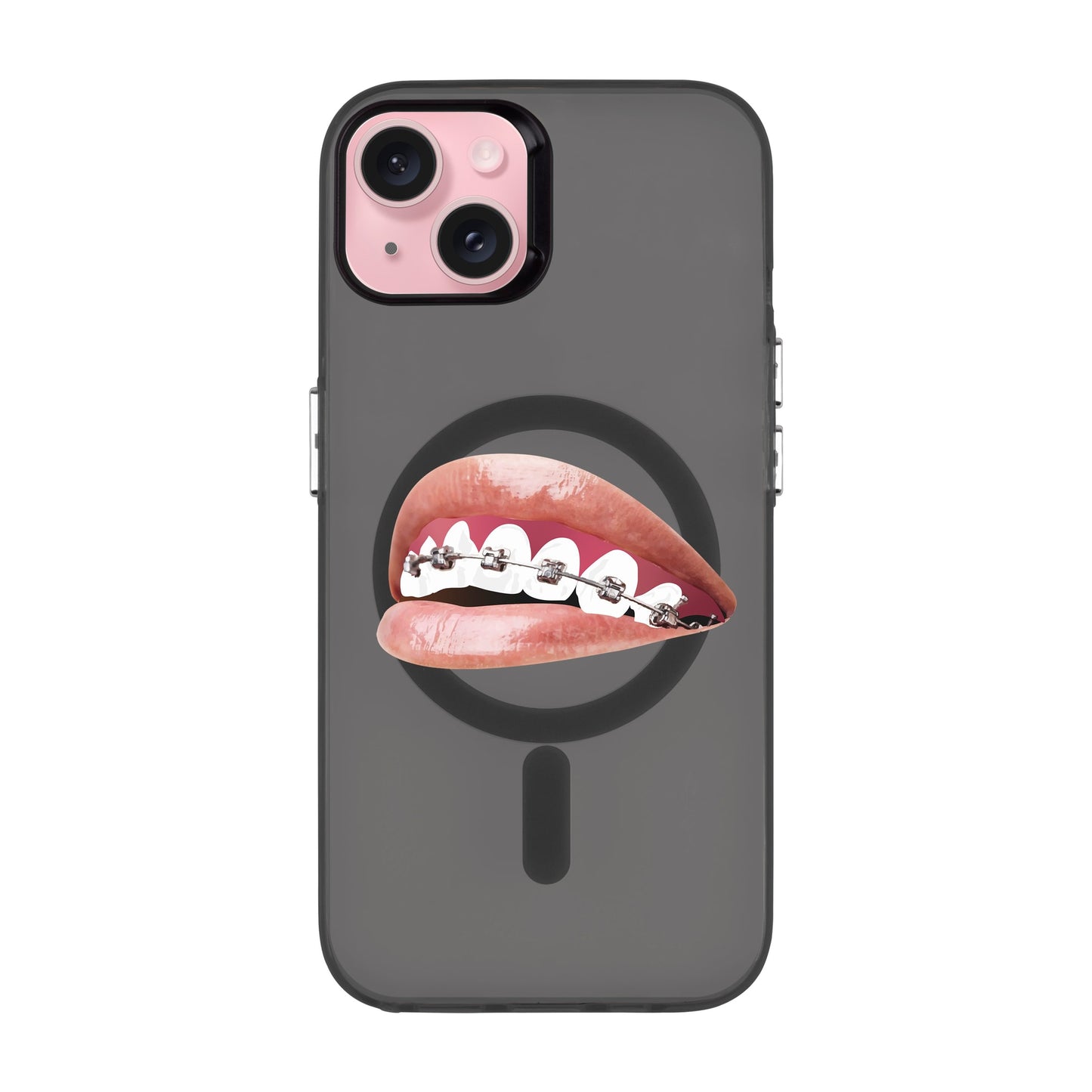 ORTHODONTIST-iPhone 15 Plus Hold Kılıf MagSafe Özellikli