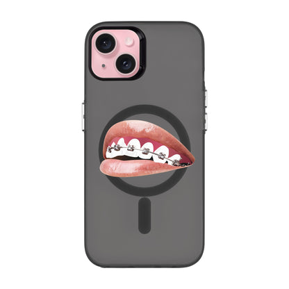 ORTHODONTIST-iPhone 15 Plus Hold Kılıf MagSafe Özellikli