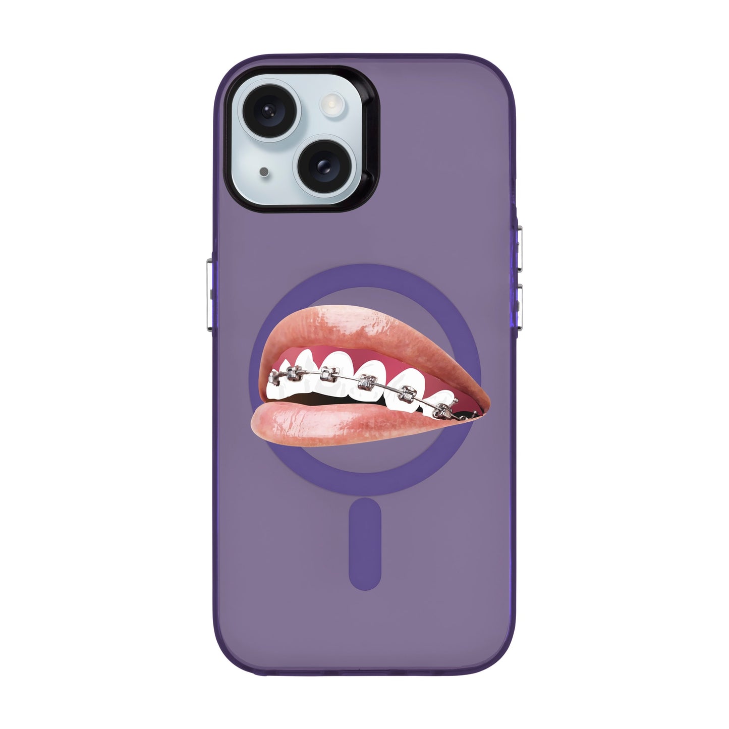 ORTHODONTIST-iPhone 15 Hold Kılıf MagSafe Özellikli