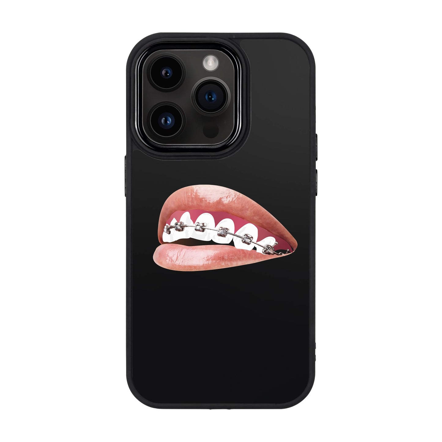 ORTHODONTIST-Proof Kılıf - iPhone 13 Pro