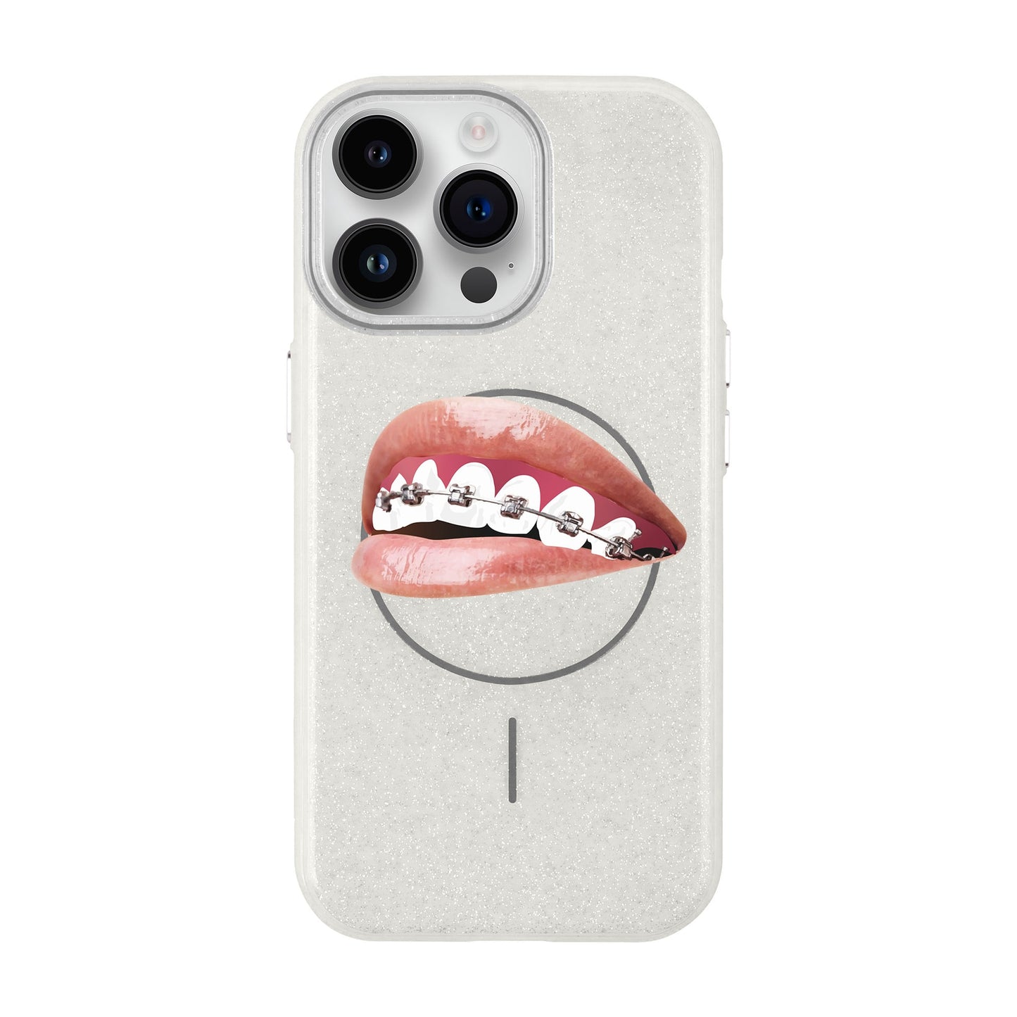 ORTHODONTIST-iPhone 14 Pro Max Radiant Kılıf MagSafe Özellikli