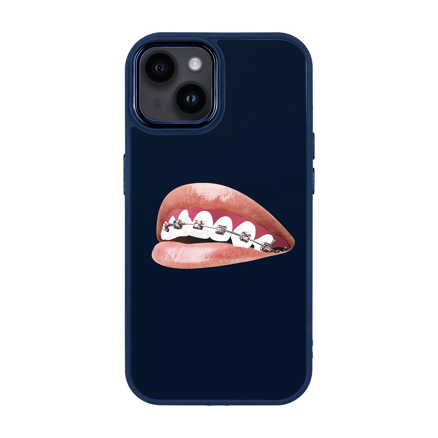 ORTHODONTIST-iPhone 14 Plus Proof Kılıf