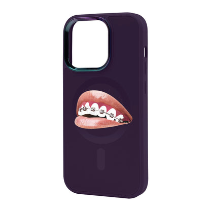 ORTHODONTİST-iPhone 14 Pro Max Vigor Kılıf MagSafe Özellikli