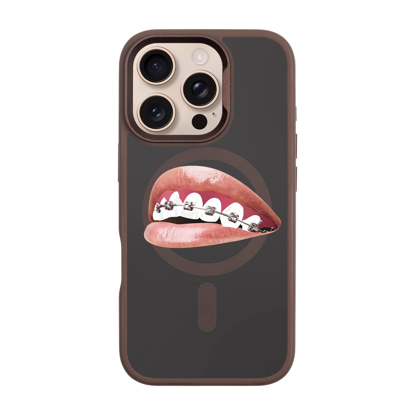 ORTHODONTIST-iPhone 16 Pro Rise Kılıf MagSafe Özellikli