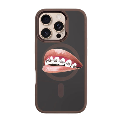ORTHODONTIST-iPhone 16 Pro Rise Kılıf MagSafe Özellikli