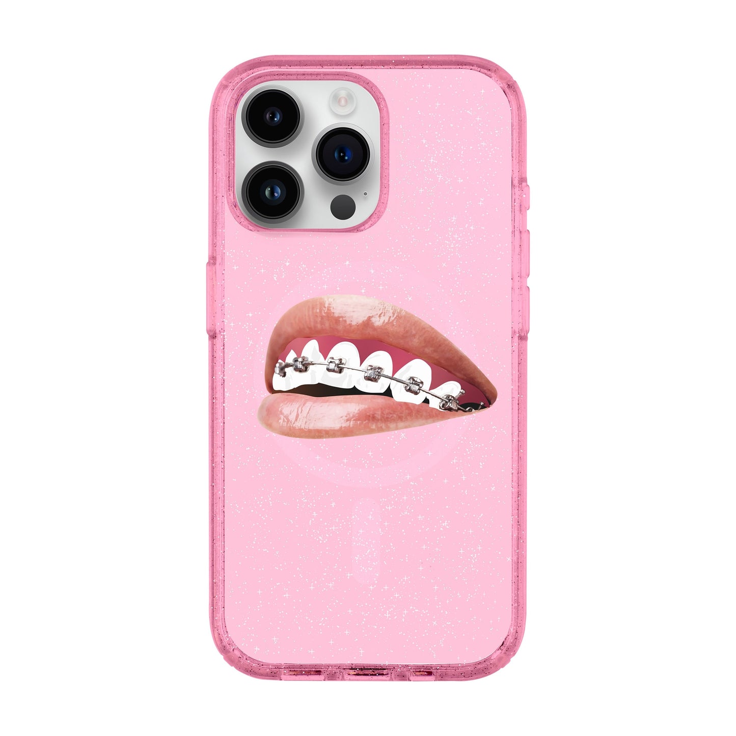 ORTHODONTIST-iPhone 14 Pro Max Shiny Kılıf MagSafe Özellikli