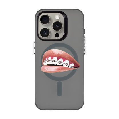 ORTHODONTIST-iPhone 15 Pro Hold Kılıf MagSafe Özellikli