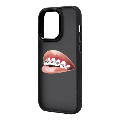 ORTHODONTIST-iPhone 14 Pro Max Proof Kılıf