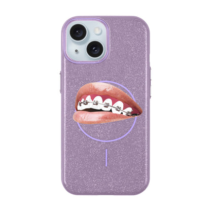 ORTHODONTIST-iPhone 15 Plus Radiant Kılıf MagSafe Özellikli