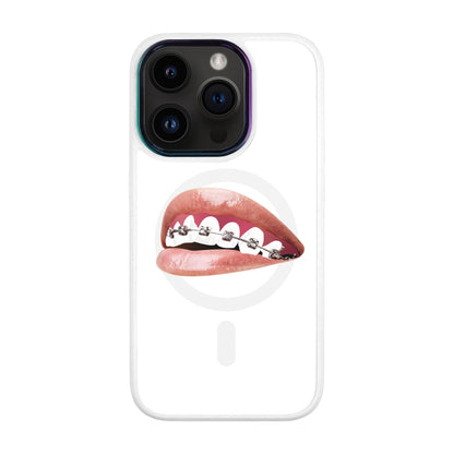 ORTHODONTİST-Vigor Kılıf MagSafe Özellikli - iPhone 14 Pro